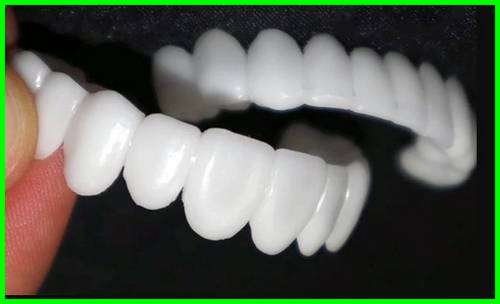 عوارض لمینت های متحرک دندان چیست 